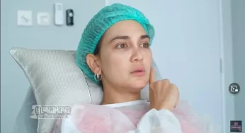Vampire Treatment : Rahasia Kulit Glowing ala Selebriti